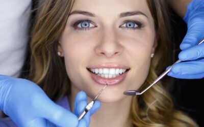 Lo sbiancamento dentale rovina i denti?